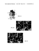 RECOMBINANT FACTOR VIII HAVING ENHANCED STABILITY FOLLOWING MUTATION AT     THE A1-C2 DOMAIN INTERFACE diagram and image