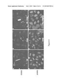 Composition and Methods for Treating Cancer diagram and image