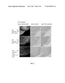 BIFUNCTIONAL TUMOR DIAGNOSIS REAGENT AND METHOD FOR TUMOR DIAGNOSIS diagram and image