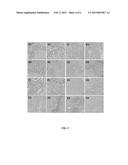 BIFUNCTIONAL TUMOR DIAGNOSIS REAGENT AND METHOD FOR TUMOR DIAGNOSIS diagram and image