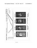 Molecular Biomarkers for Predicting Response to Tyrosine Kinase Inhibitors     in Lung Cancer diagram and image