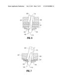 DEVICES, SYSTEMS, AND METHODS FOR WOUND CLOSURE diagram and image