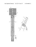 MEDICAL IMPLANTABLE LEAD WITH FIXATION DETECTION diagram and image