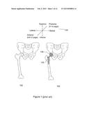 STERILE OPTICAL SENSOR SYSTEM HAVING AN ADJUSTMENT MECHANISM diagram and image