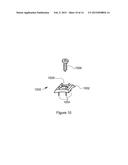 STERILE OPTICAL SENSOR SYSTEM HAVING AN ADJUSTMENT MECHANISM diagram and image