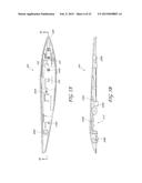 SYSTEM FOR DELIVERING MULTIPLE OCULAR IMPLANTS diagram and image