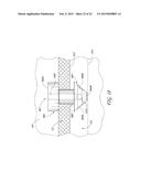 SYSTEM FOR DELIVERING MULTIPLE OCULAR IMPLANTS diagram and image