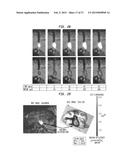 SYSTEMS AND METHODS FOR DRUG DELIVERY, TREATMENT, AND MONITORING diagram and image