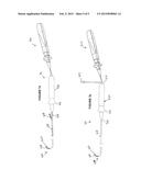 ABLATION CATHETER diagram and image