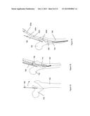 SURGICAL IMPLANT DEVICE, METHOD AND APPARATUS FOR IMPLANTING THEREOF diagram and image