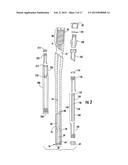 Intramedullary Nail System including Tang-deployment Screw with Male     Interface diagram and image