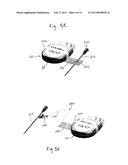 ADAPTER FOR CONNECTION TO PULSE GENERATOR diagram and image