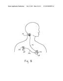 ADAPTER FOR CONNECTION TO PULSE GENERATOR diagram and image