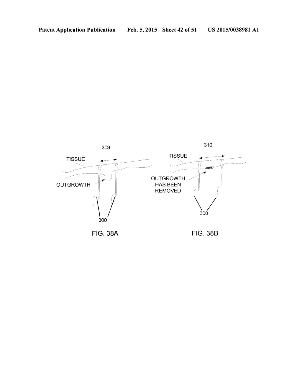 HYPERDEXTEROUS SURGICAL SYSTEM - diagram, schematic, and image 43