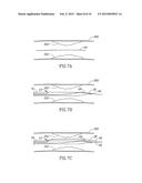 SYSTEMS AND METHODS FOR TREATING A VESSEL USING FOCUSED FORCE diagram and image