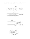 SYSTEMS AND METHODS FOR TREATING A VESSEL USING FOCUSED FORCE diagram and image