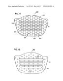 NASAL SUPPORT DEVICE AND METHOD diagram and image