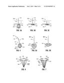 Tissue Fixation Device diagram and image