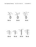 Tissue Fixation Device diagram and image