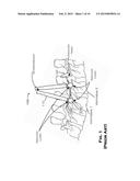 SKELETAL BONE FIXATION MECHANISM diagram and image