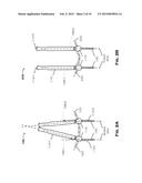 SKELETAL BONE FIXATION MECHANISM diagram and image