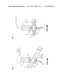 SKELETAL BONE FIXATION MECHANISM diagram and image