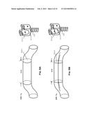 SKELETAL BONE FIXATION MECHANISM diagram and image