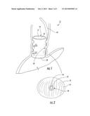 MUCOSAL CAPTURE FIXATION OF MEDICAL DEVICE diagram and image