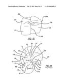 Dual Chambered Passenger Airbag diagram and image