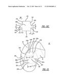 Dual Chambered Passenger Airbag diagram and image