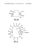 Dual Chambered Passenger Airbag diagram and image