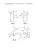 Dual Chambered Passenger Airbag diagram and image