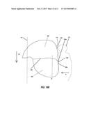 Dual Chambered Passenger Airbag diagram and image