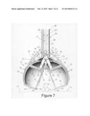 Object-Enclosing Chambered Scooper diagram and image