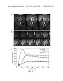 DYNAMIC CONTRAST ENHANCED MAGNETIC RESONANCE IMAGING WITH HIGH     SPATIAL-TEMPORAL RESOLUTION diagram and image