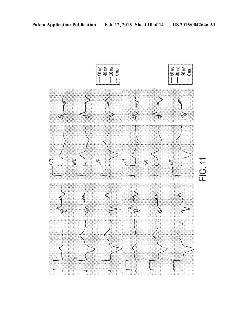 System and Method for Patient Specific Planning and Guidance of     Electrophysiology Interventions - diagram, schematic, and image 11