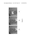 METHOD AND SYSTEM TO ASSIST 2D-3D IMAGE REGISTRATION diagram and image