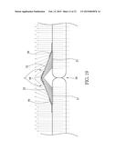 OPTICAL FIBER WITH IMAGE ENHANCEMENT diagram and image