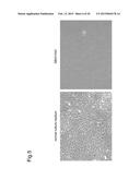 NORMALIZATION OF CULTURE OF CORNEAL ENDOTHELIAL CELLS diagram and image