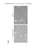 NORMALIZATION OF CULTURE OF CORNEAL ENDOTHELIAL CELLS diagram and image