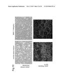 NORMALIZATION OF CULTURE OF CORNEAL ENDOTHELIAL CELLS diagram and image