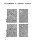 NORMALIZATION OF CULTURE OF CORNEAL ENDOTHELIAL CELLS diagram and image