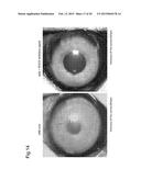NORMALIZATION OF CULTURE OF CORNEAL ENDOTHELIAL CELLS diagram and image