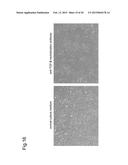 NORMALIZATION OF CULTURE OF CORNEAL ENDOTHELIAL CELLS diagram and image