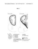 Brain-Specific Enhancers for Cell-Based Therapy diagram and image