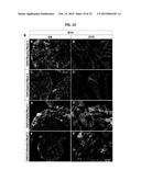 Brain-Specific Enhancers for Cell-Based Therapy diagram and image