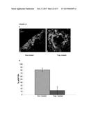 SOLUBLE IGF RECEPTOR Fc FUSION PROTEINS AND USES THEREOF diagram and image