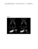 SOLUBLE IGF RECEPTOR Fc FUSION PROTEINS AND USES THEREOF diagram and image