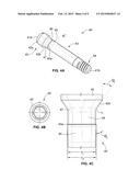 DENTAL ABUTMENT SYSTEM diagram and image