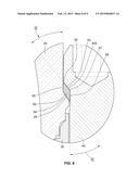 DENTAL ABUTMENT SYSTEM diagram and image